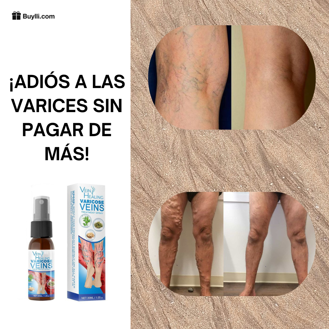 Spray NO + VARICES - Solo x Hoy Incluye 12 Parches GRATIS