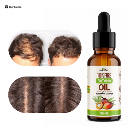 Aceite de Batana 30ml - ¡Crecimiento del Cabello en Semanas!